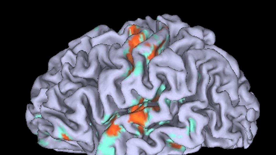 Scoperto nel cervello il motore dell'effetto placebo