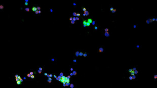 Tumori ematologici e CAR-T, studio svela possibile complicazione