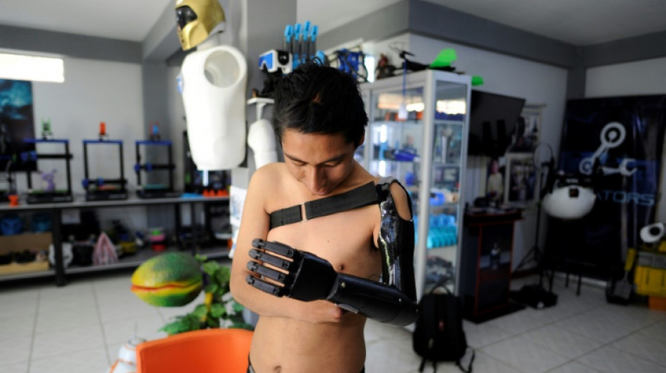 Bolivian toymaker restores limbs, dignity with 3D-printing